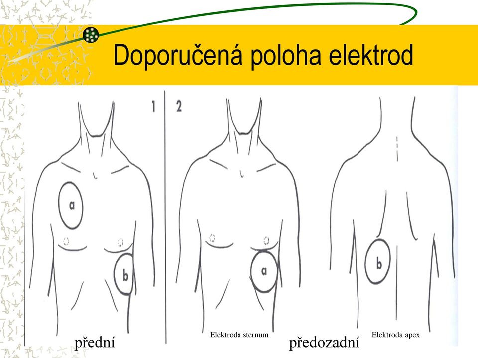 Elektroda sternum