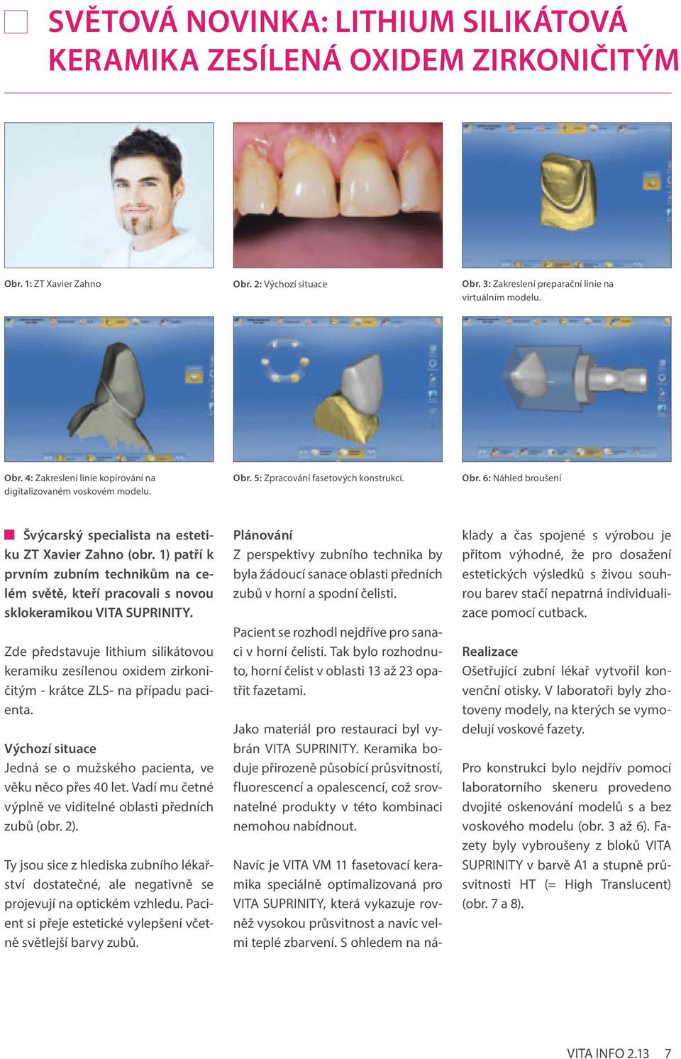 1) patří k prvním zubním technikům na celém světě, kteří pracovali s novou sklokeramikou VITA SUPRINITY.