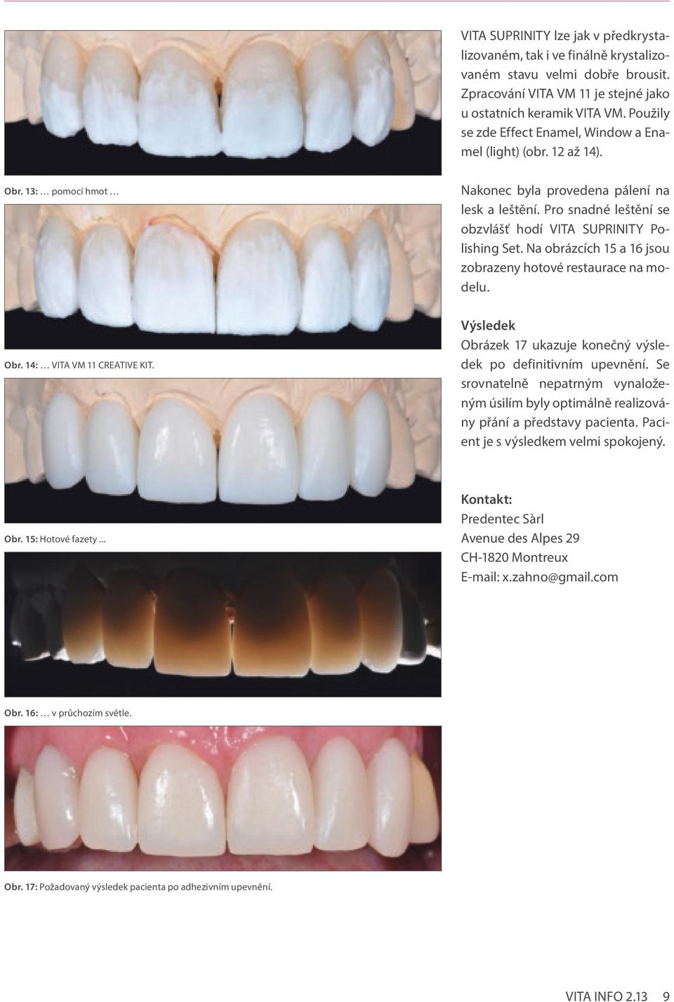 Pro snadné leštění se obzvlášť hodí VITA SUPRINITY Polishing Set. Na obrázcích 15 a 16 jsou zobrazeny hotové restaurace na modelu. Obr. 14: VITA VM 11 CREATIVE KIT.