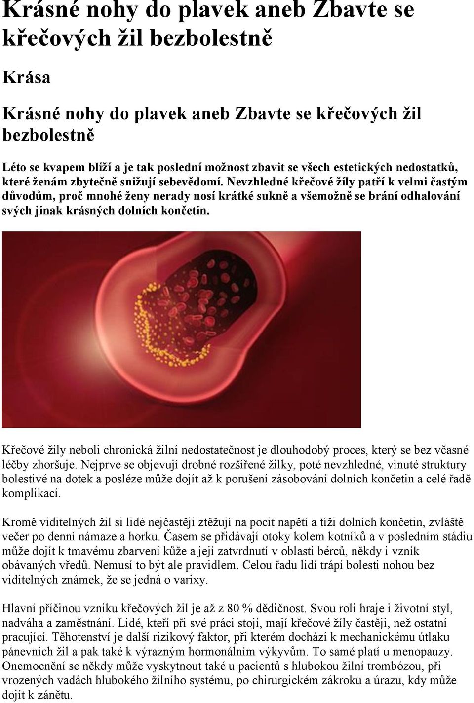 Nevzhledné křečové žíly patří k velmi častým důvodům, proč mnohé ženy nerady nosí krátké sukně a všemožně se brání odhalování svých jinak krásných dolních končetin.