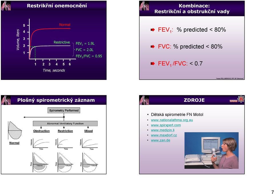 9 FEV : % predicted < 80% FVC: % predicted < 80% 6 FEV /FVC: < 0.