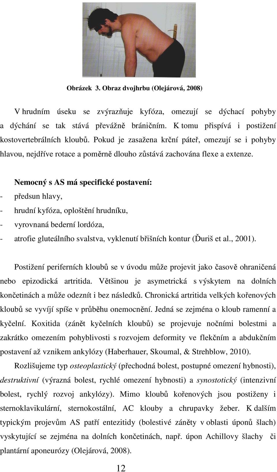 Nemocný s AS má specifické postavení: - předsun hlavy, - hrudní kyfóza, oploštění hrudníku, - vyrovnaná bederní lordóza, - atrofie gluteálního svalstva, vyklenutí břišních kontur (Ďuriš et al., 2001).