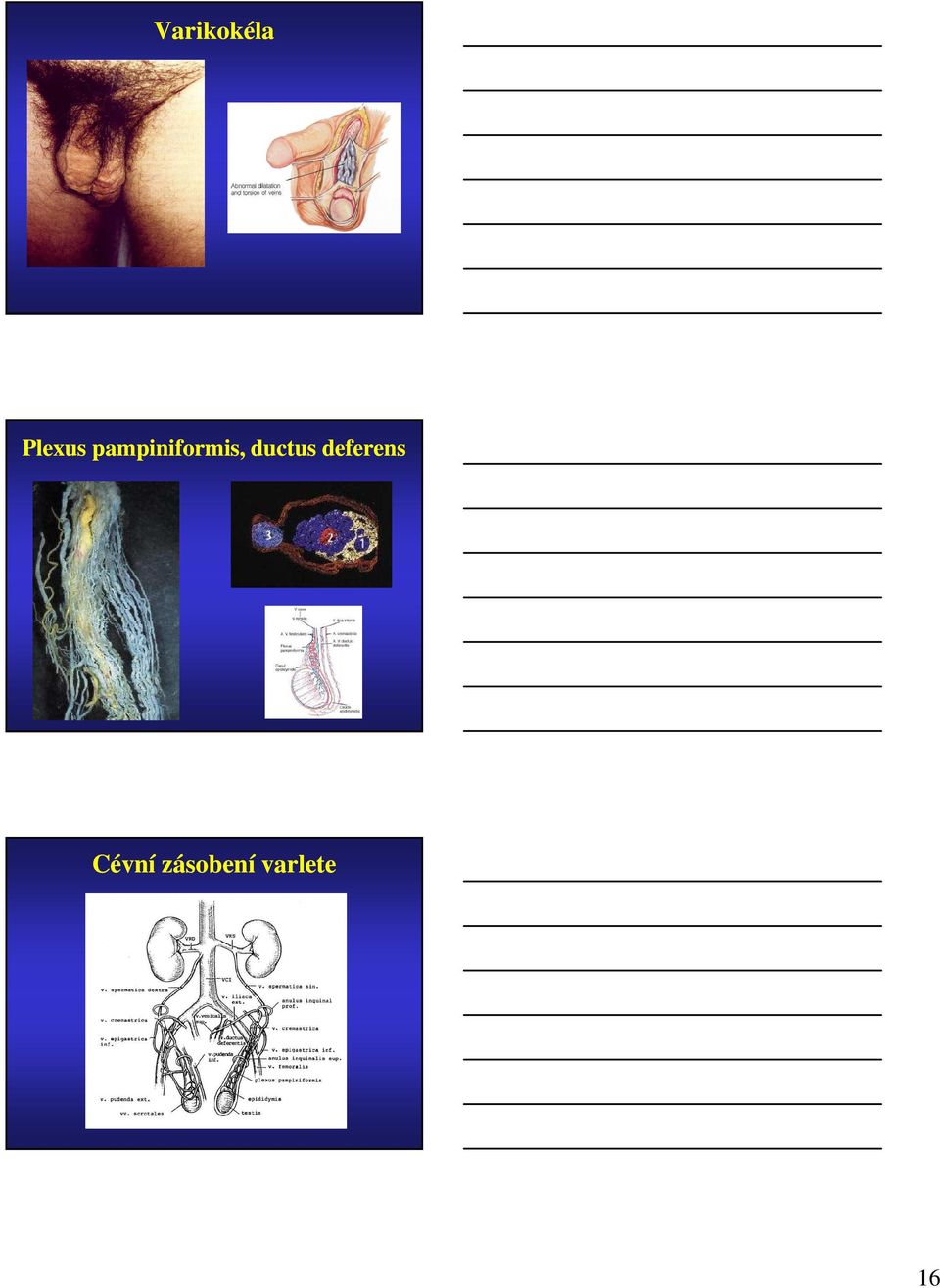 ductus deferens