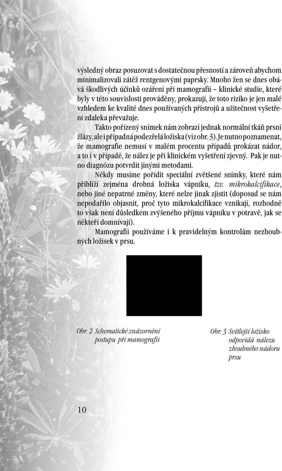 přístrojů a užitečnost vyšetření zdaleka převažuje. Takto pořízený snímek nám zobrazí jednak normální tkáň prsní žlázy, ale i případná podezřelá ložiska (viz obr. 3).