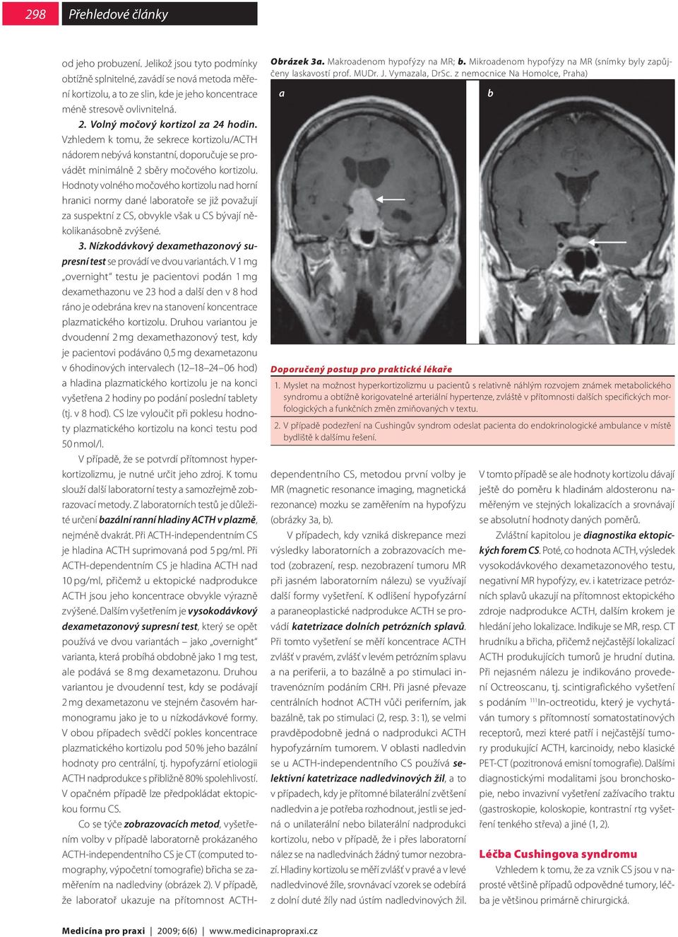 Myslet na možnost hyperkortizolizmu u pacientů s relativně náhlým rozvojem známek metabolického syndromu a obtížně korigovatelné arteriální hypertenze, zvláště v přítomnosti dalších specifických