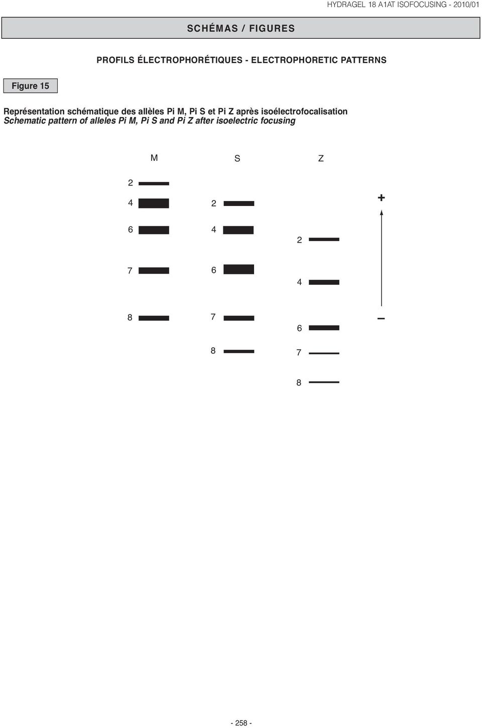 après isoélectrofocalisation Schematic pattern of alleles Pi M, Pi S