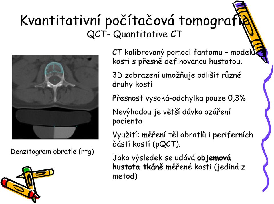 3D zobrazení umožňuje odlišit různé druhy kostí Přesnost vysoká-odchylka pouze 0,3% Nevýhodou je