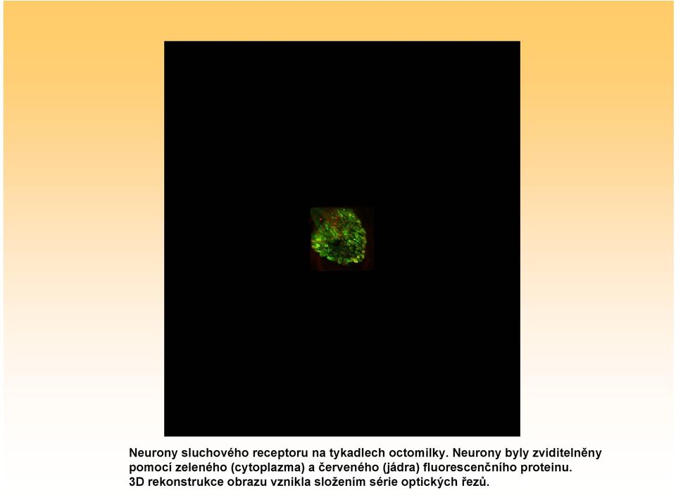 (cytoplazma) a červeného (jádra) fluorescenčního