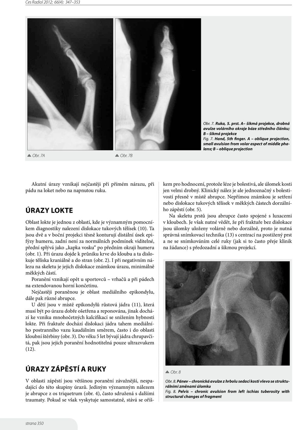 ÚRAZY LOKTE Oblast lokte je jednou z oblastí, kde je významným pomocníkem diagnostiky nalezení dislokace tukových tělísek (10).