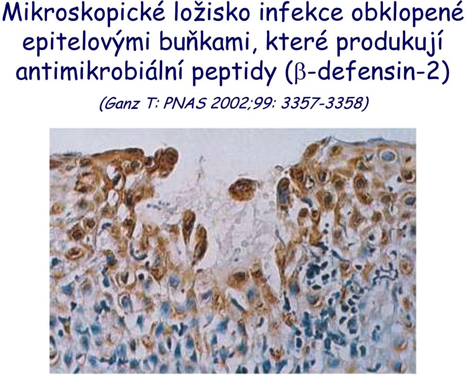 produkují antimikrobiální peptidy