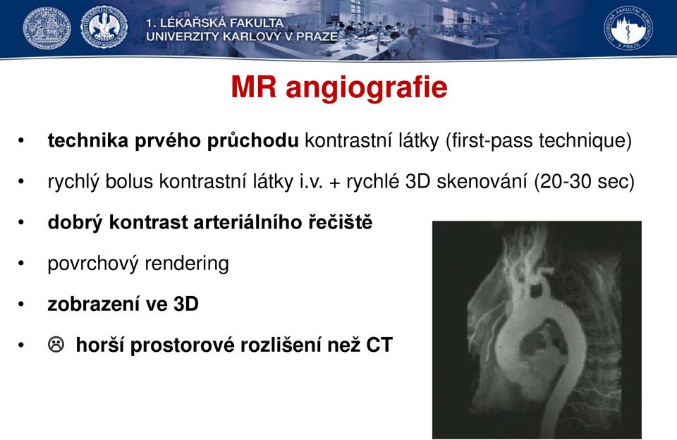 + rychlé 3D skenování (20-30 sec) dobrý kontrast arteriálního