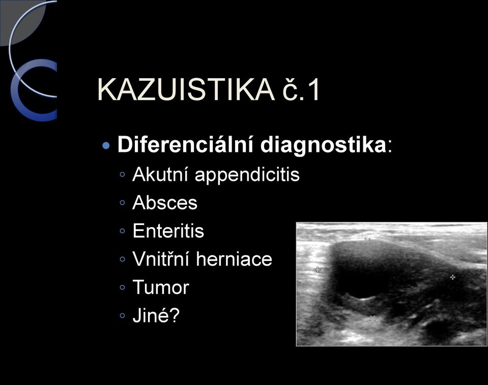 diagnostika: Akutní