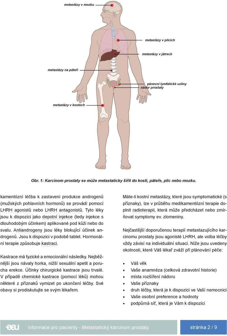 kamentózní léčba k zastavení produkce androgenů (mužských pohlavních hormonů) se provádí pomocí LHRH agonistů nebo LHRH antagonistů.