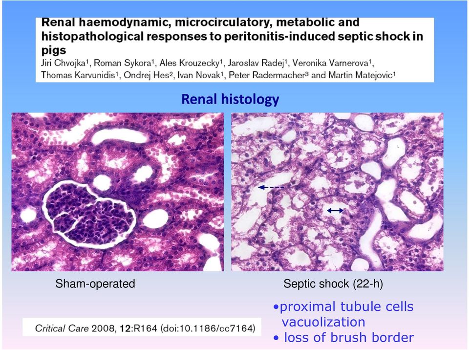 (22-h) proximal tubule