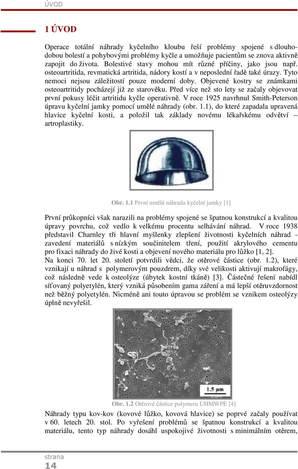 Objevené kostry se známkami osteoartritidy pocházejí již ze starověku. Před více než sto lety se začaly objevovat první pokusy léčit artritidu kyčle operativně.