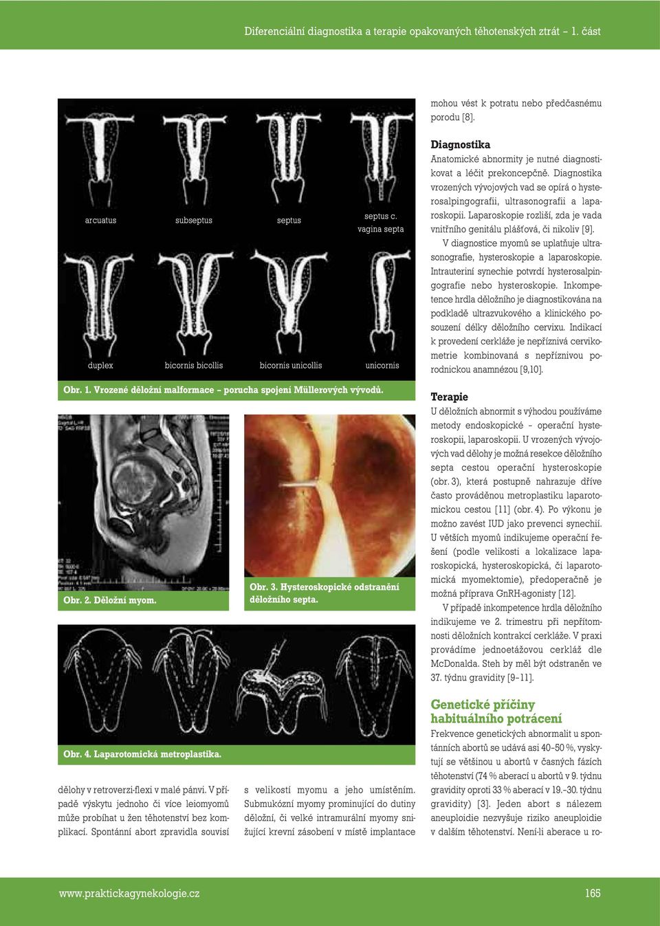 Anatomické abnormity je nutné diagnostikovat a léčit prekoncepčně. vrozených vývojových vad se opírá o hysterosalpingografii, ultrasonografii a laparoskopii.