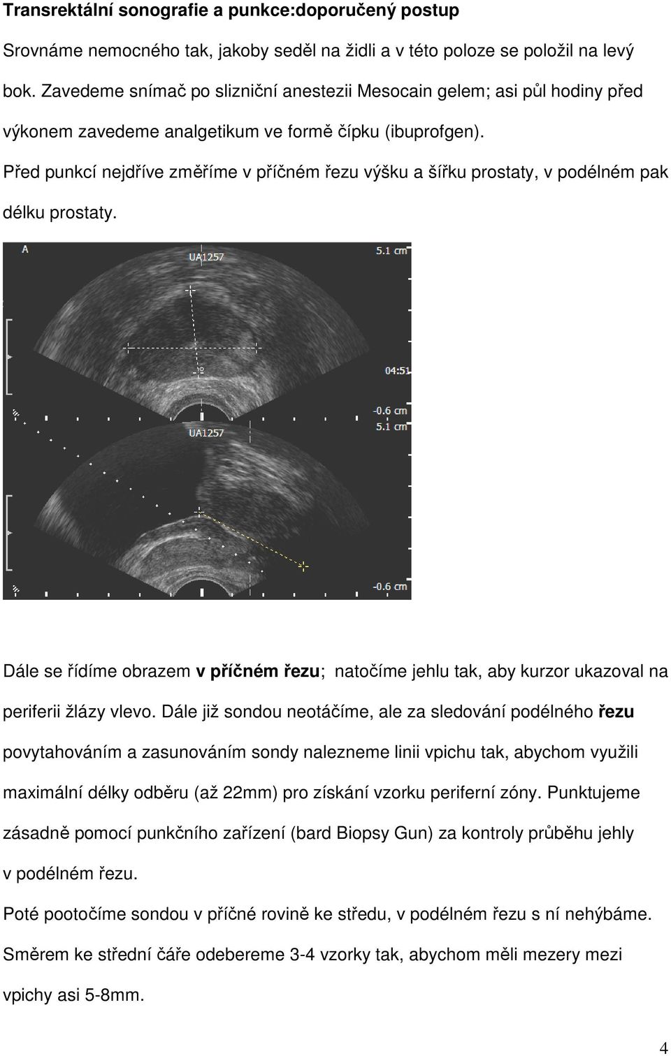 Před punkcí nejdříve změříme v příčném řezu výšku a šířku prostaty, v podélném pak délku prostaty.