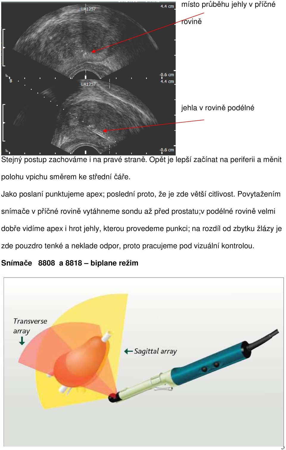 Jako poslaní punktujeme apex; poslední proto, že je zde větší citlivost.