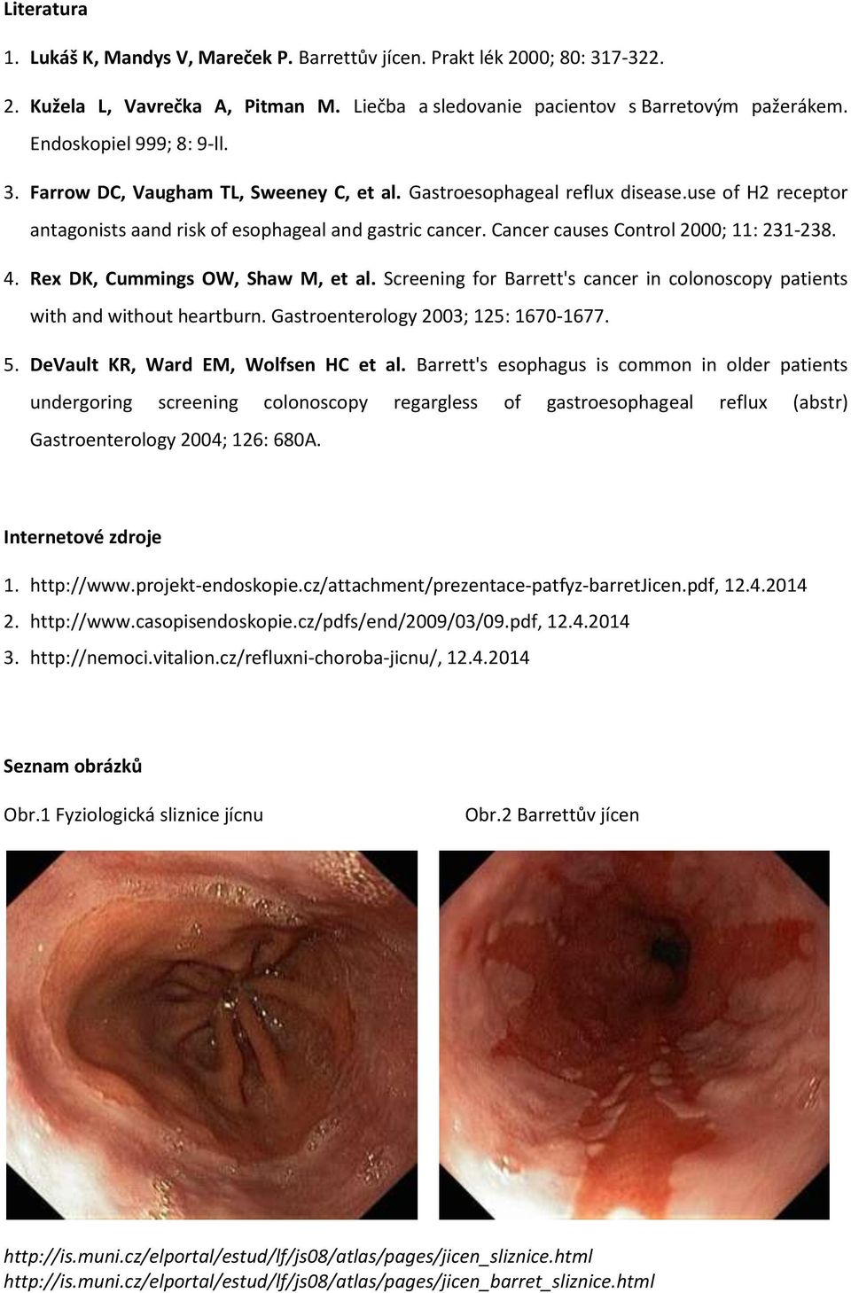 Cancer causes Control 2000; 11: 231-238. 4. Rex DK, Cummings OW, Shaw M, et al. Screening for Barrett's cancer in colonoscopy patients with and without heartburn.
