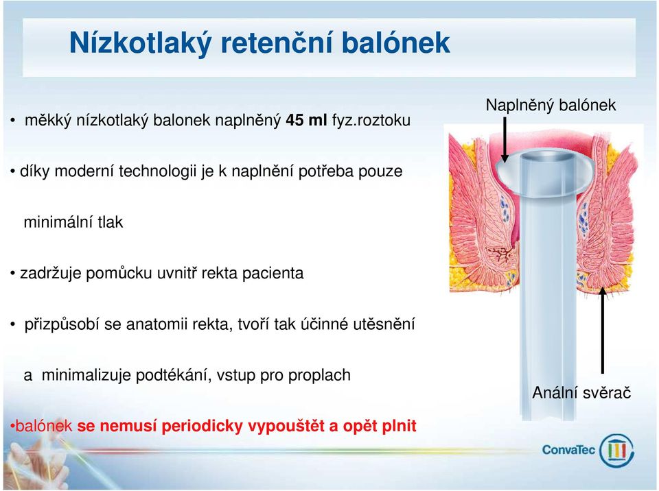 zadržuje pomůcku uvnitř rekta pacienta přizpůsobí se anatomii rekta, tvoří tak účinné