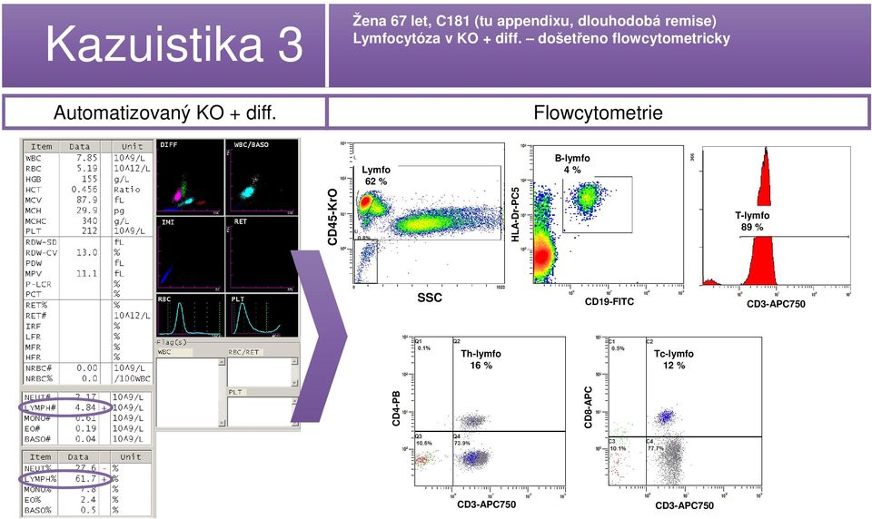 došetřeno flowcytometricky Automatizovaný KO + diff.