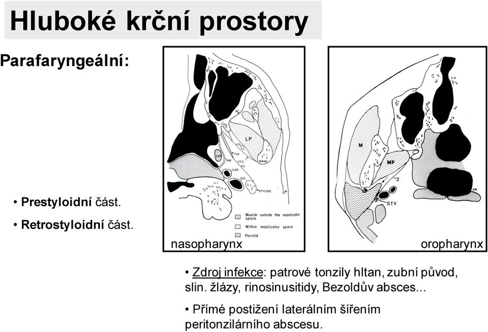 nasopharynx oropharynx Zdroj infekce: patrové tonzily hltan,
