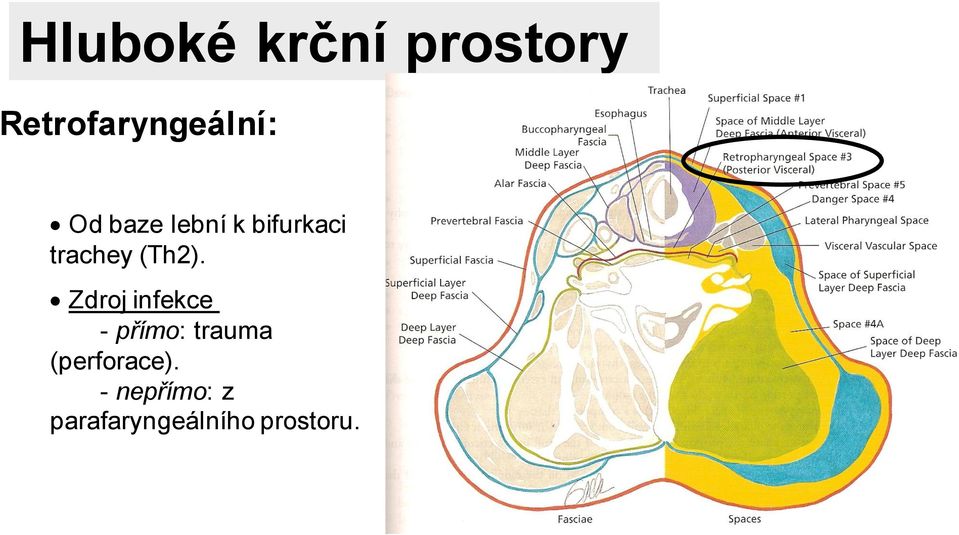 Zdroj infekce - přímo: trauma (perforace).