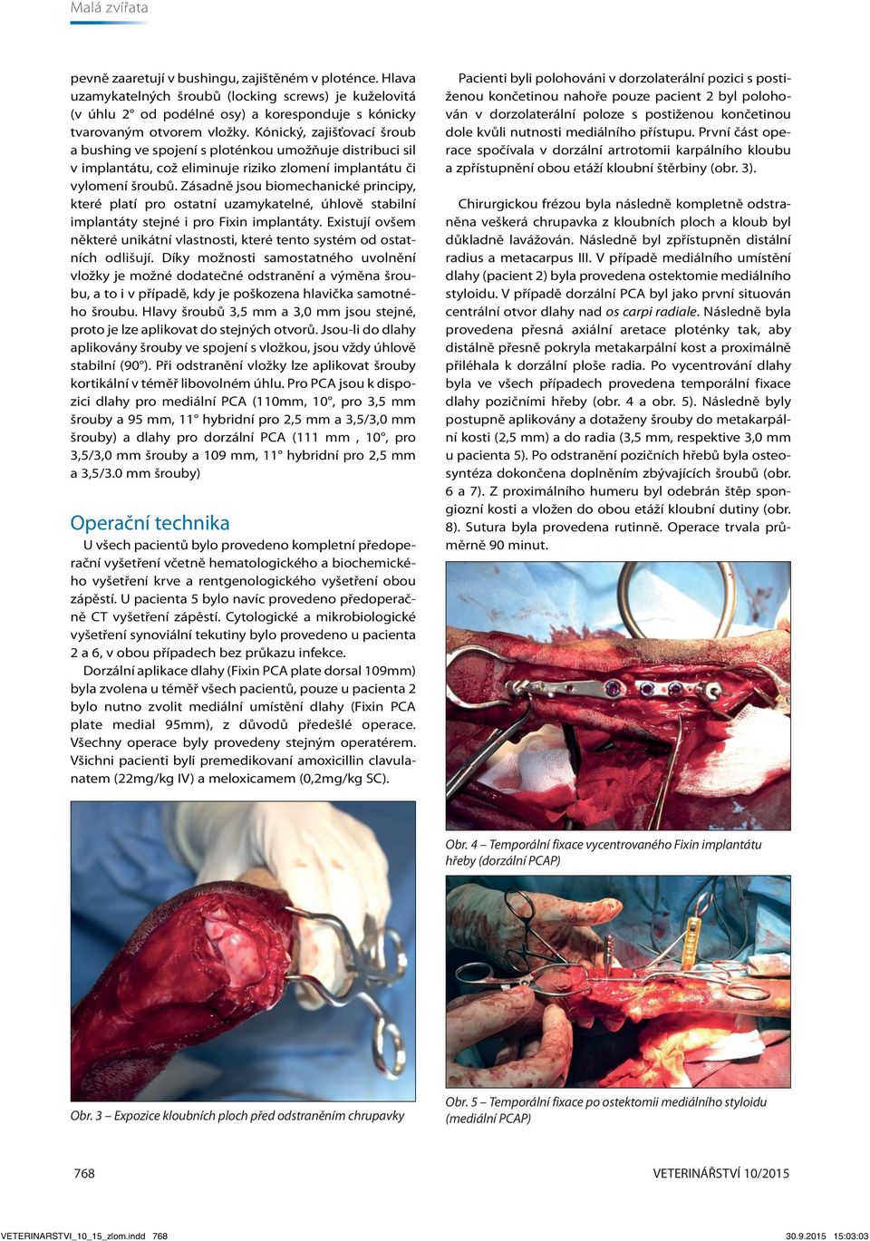 Zásadně jsou biomechanické principy, které platí pro ostatní uzamykatelné, úhlově stabilní implantáty stejné i pro Fixin implantáty.