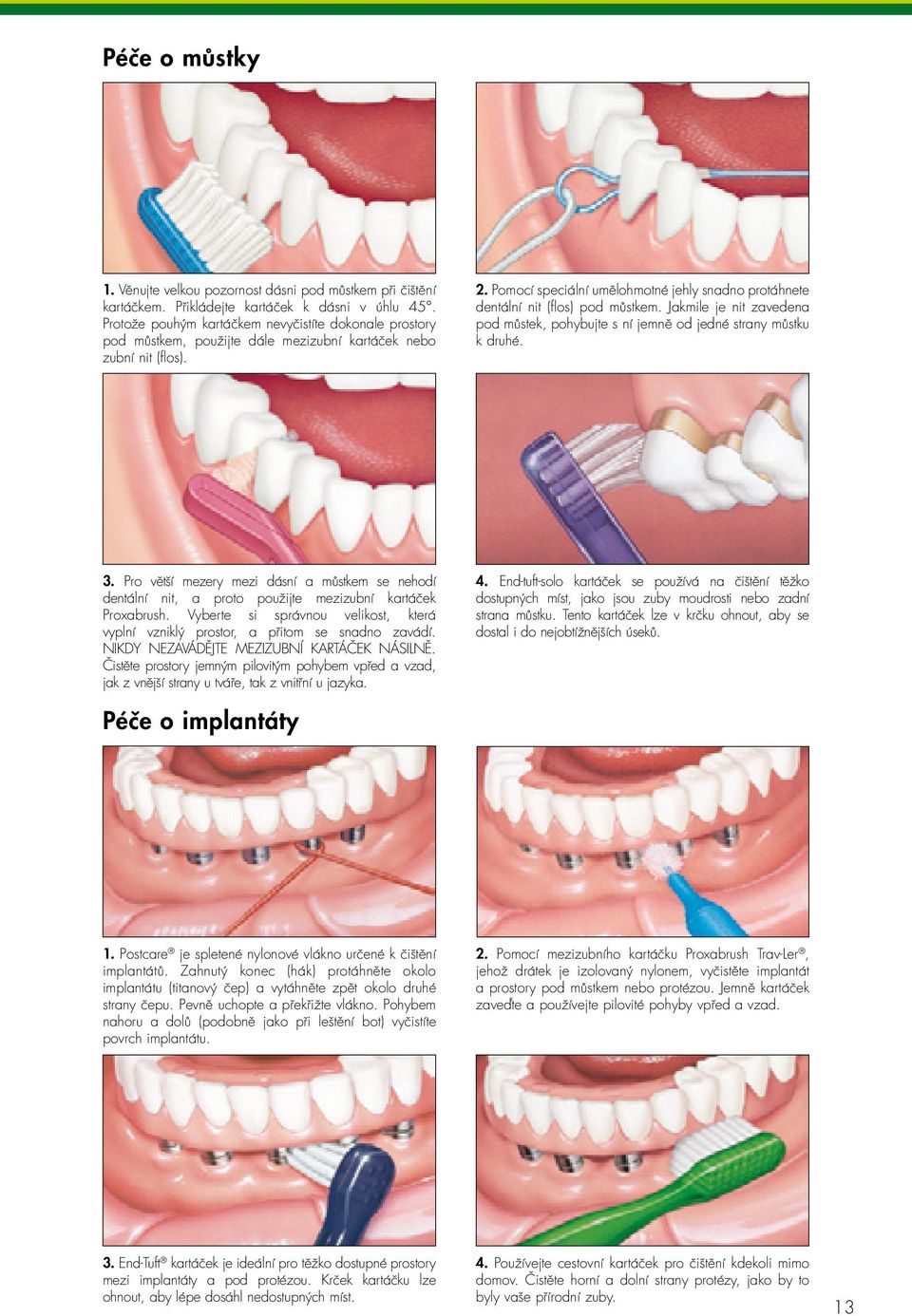 Pomocí speciální umělohmotné jehly snadno protáhnete dentální nit (flos) pod můstkem. Jakmile je nit zavedena pod můstek, pohybujte s ní jemně od jedné strany můstku k druhé. 3.