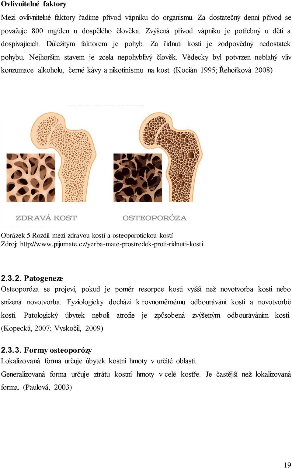 Vědecky byl potvrzen neblahý vliv konzumace alkoholu, černé kávy a nikotinismu na kost. (Kocián 1995; Řehořková 2008) Obrázek 5 Rozdíl mezi zdravou kostí a osteoporotickou kostí Zdroj: http://www.