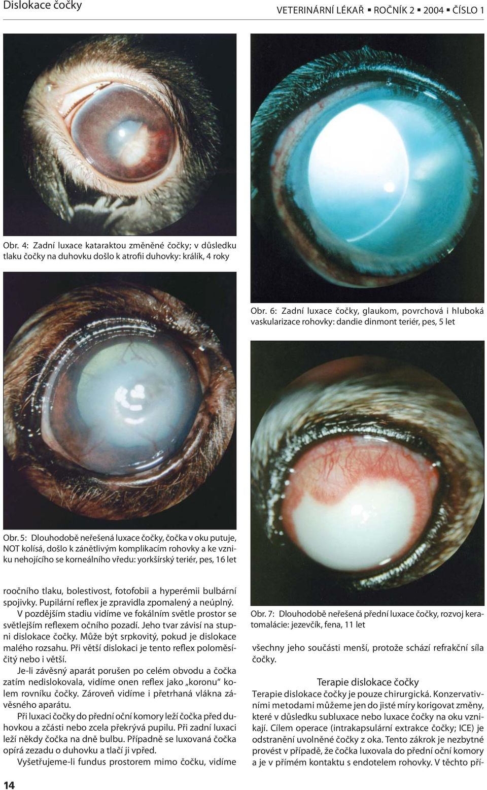 5: Dlouhodobě neřešená luxace čočky, čočka v oku putuje, NOT kolísá, došlo k zánětlivým komplikacím rohovky a ke vzniku nehojícího se korneálního vředu: yorkšírský teriér, pes, 16 let roočního tlaku,