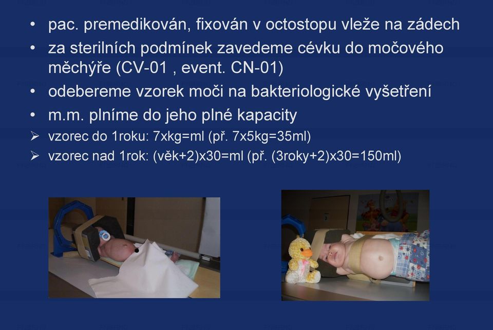 CN-01) odebereme vzorek moči na bakteriologické vyšetření m.m. plníme do jeho plné kapacity vzorec do 1roku: 7xkg=ml (př.