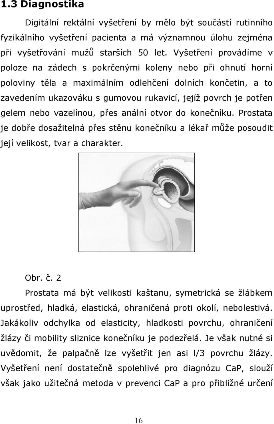 potřen gelem nebo vazelínou, přes anální otvor do konečníku. Prostata je dobře dosažitelná přes stěnu konečníku a lékař může posoudit její velikost, tvar a charakter. Obr. č.