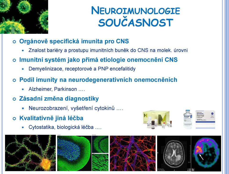 úrovni Imunitní systém jako přímá etiologie onemocnění CNS Demyelinizace, receptorové a PNP encefalitidy