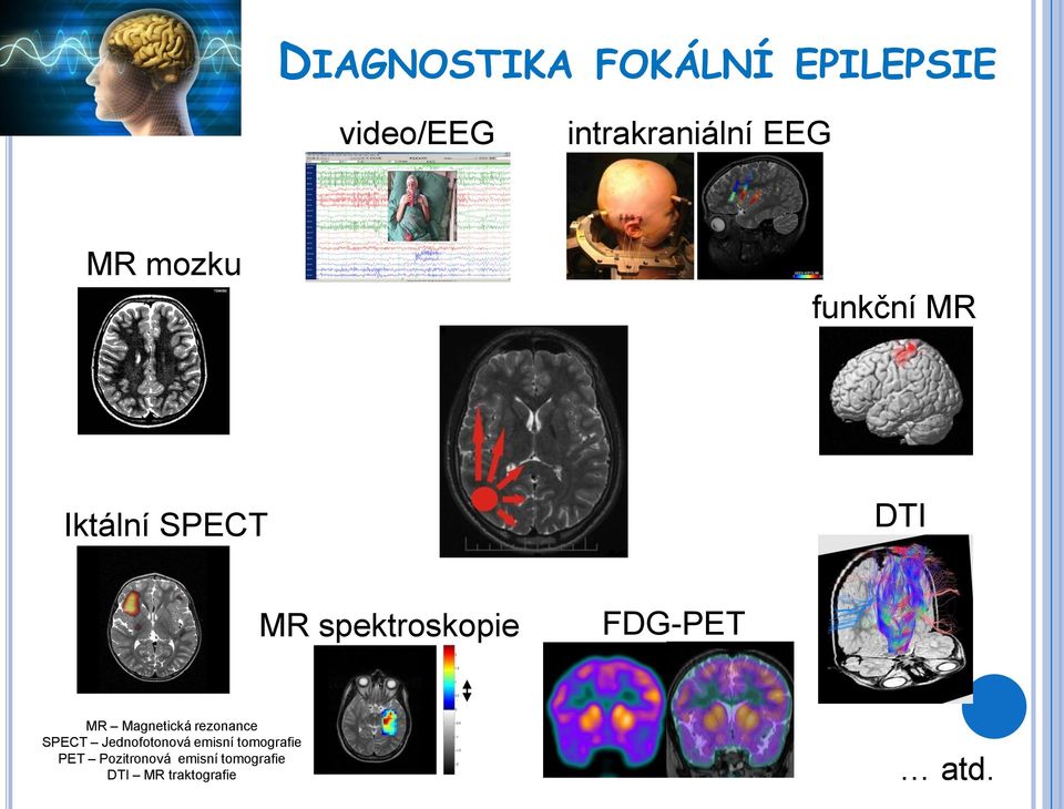 FDG-PET MR Magnetická rezonance SPECT Jednofotonová emisní