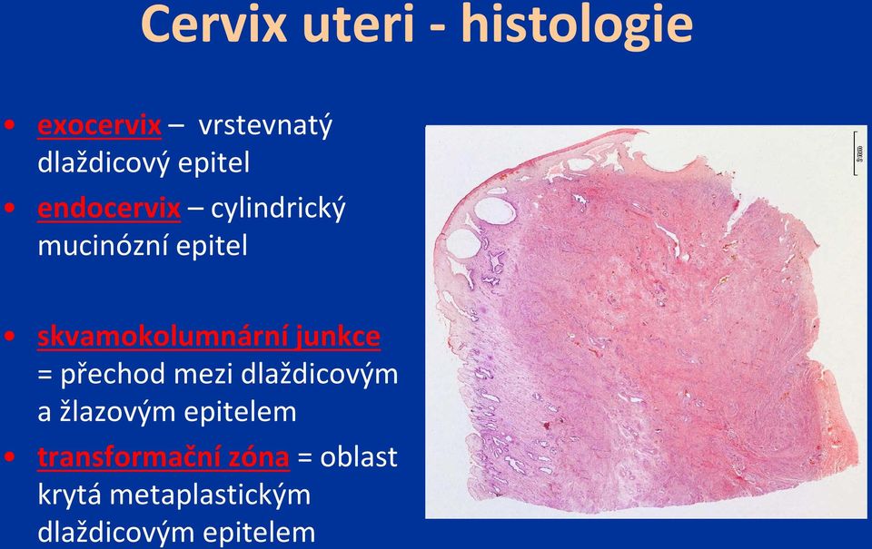 skvamokolumnární junkce = přechod mezi dlaždicovým a žlazovým