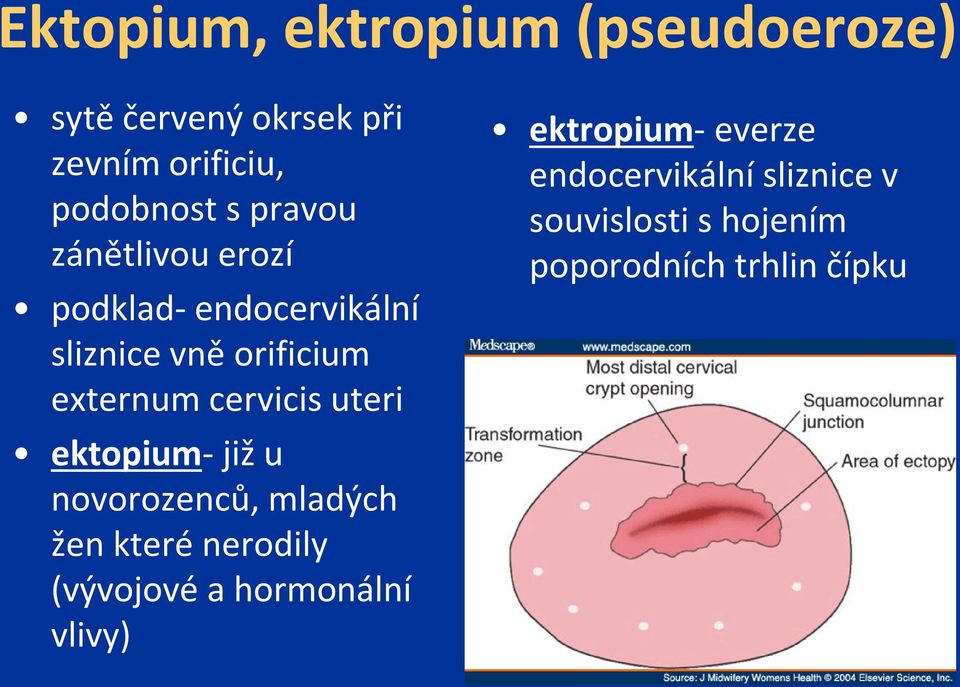 uteri ektopium- již u novorozenců, mladých žen které nerodily (vývojové a hormonální