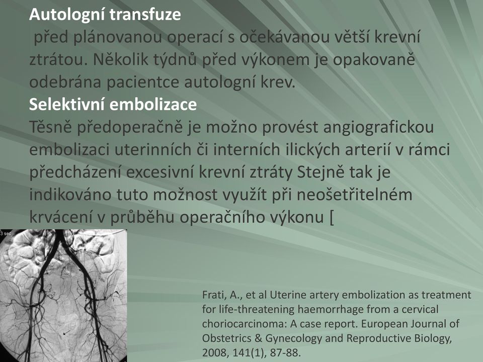 ztráty Stejně tak je indikováno tuto možnost využít při neošetřitelném krvácení v průběhu operačního výkonu [ Frati, A.