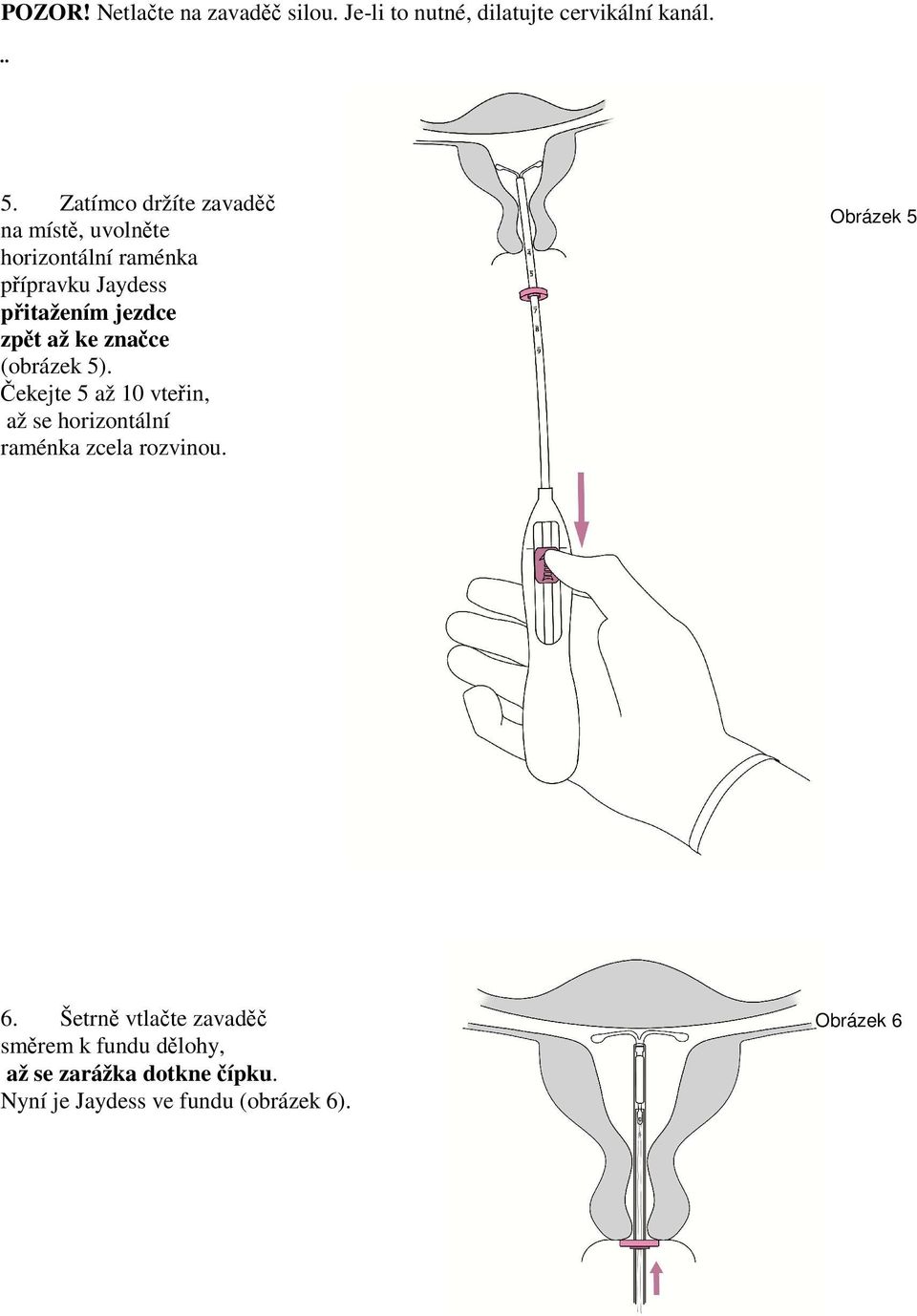 až ke značce (obrázek 5). Čekejte 5 až 10 vteřin, až se horizontální raménka zcela rozvinou.