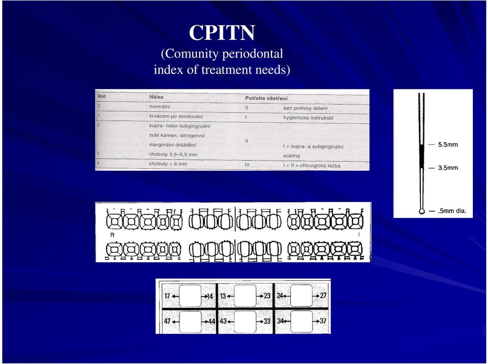 periodontal