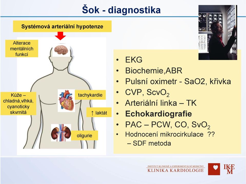 EKG Biochemie,ABR Pulsní oximetr - SaO2, křivka CVP, ScvO 2 Arteriální