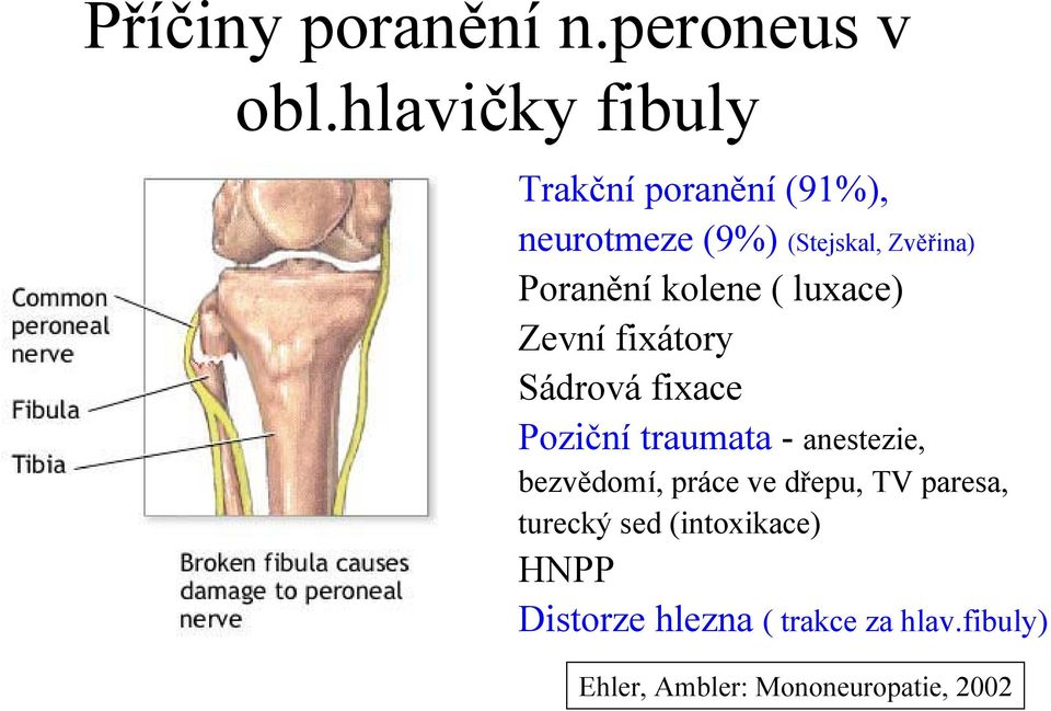 kolene ( luxace) Zevní fixátory Sádrová fixace Poziční traumata - anestezie,