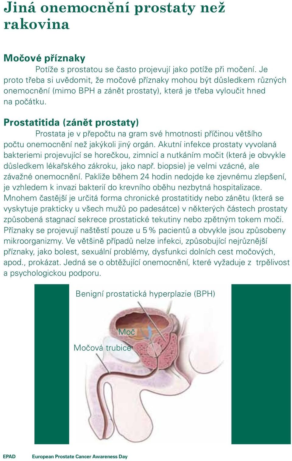 Prostatitida (zánět prostaty) Prostata je v přepočtu na gram své hmotnosti příčinou většího počtu onemocnění než jakýkoli jiný orgán.