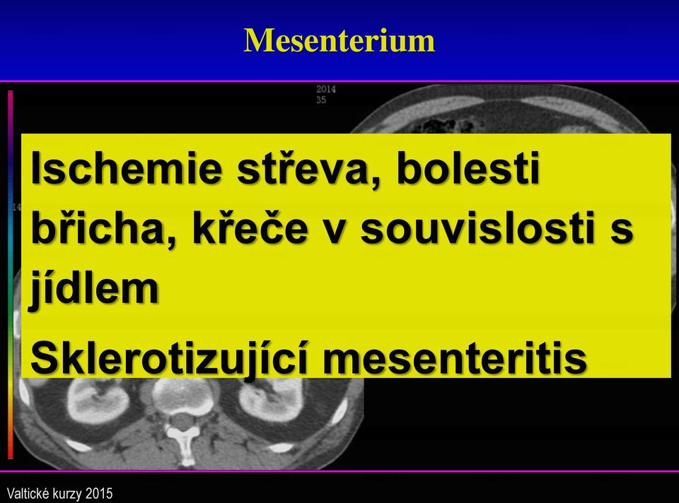 křeče v souvislosti s