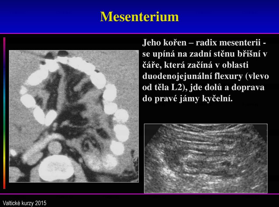 začíná v oblasti duodenojejunální flexury