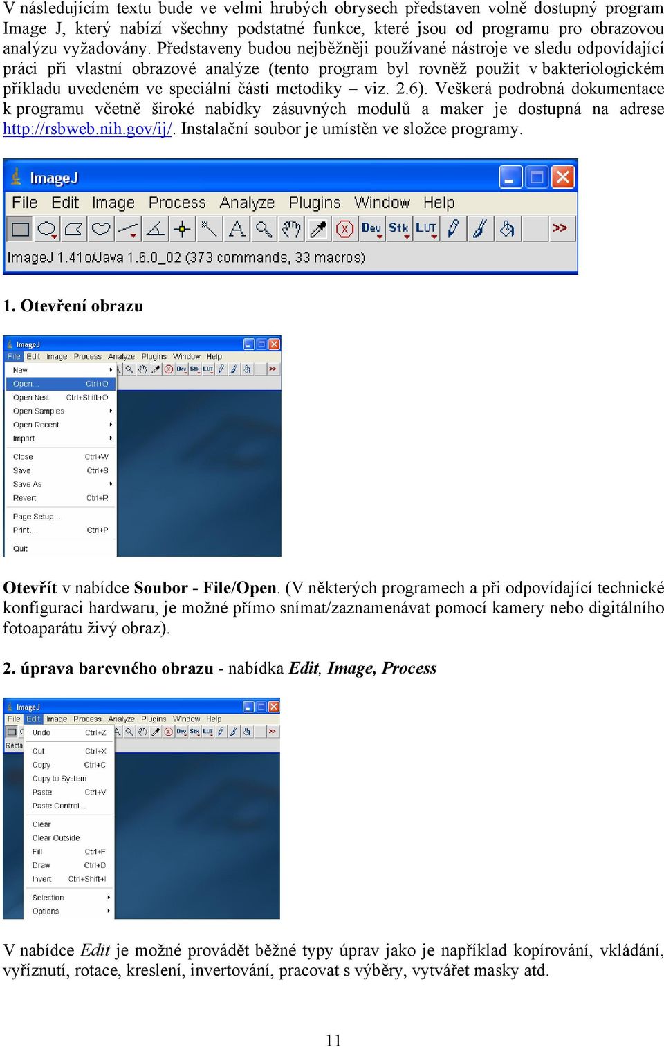 metodiky viz. 2.6). Veškerá podrobná dokumentace k programu včetně široké nabídky zásuvných modulů a maker je dostupná na adrese http://rsbweb.nih.gov/ij/.
