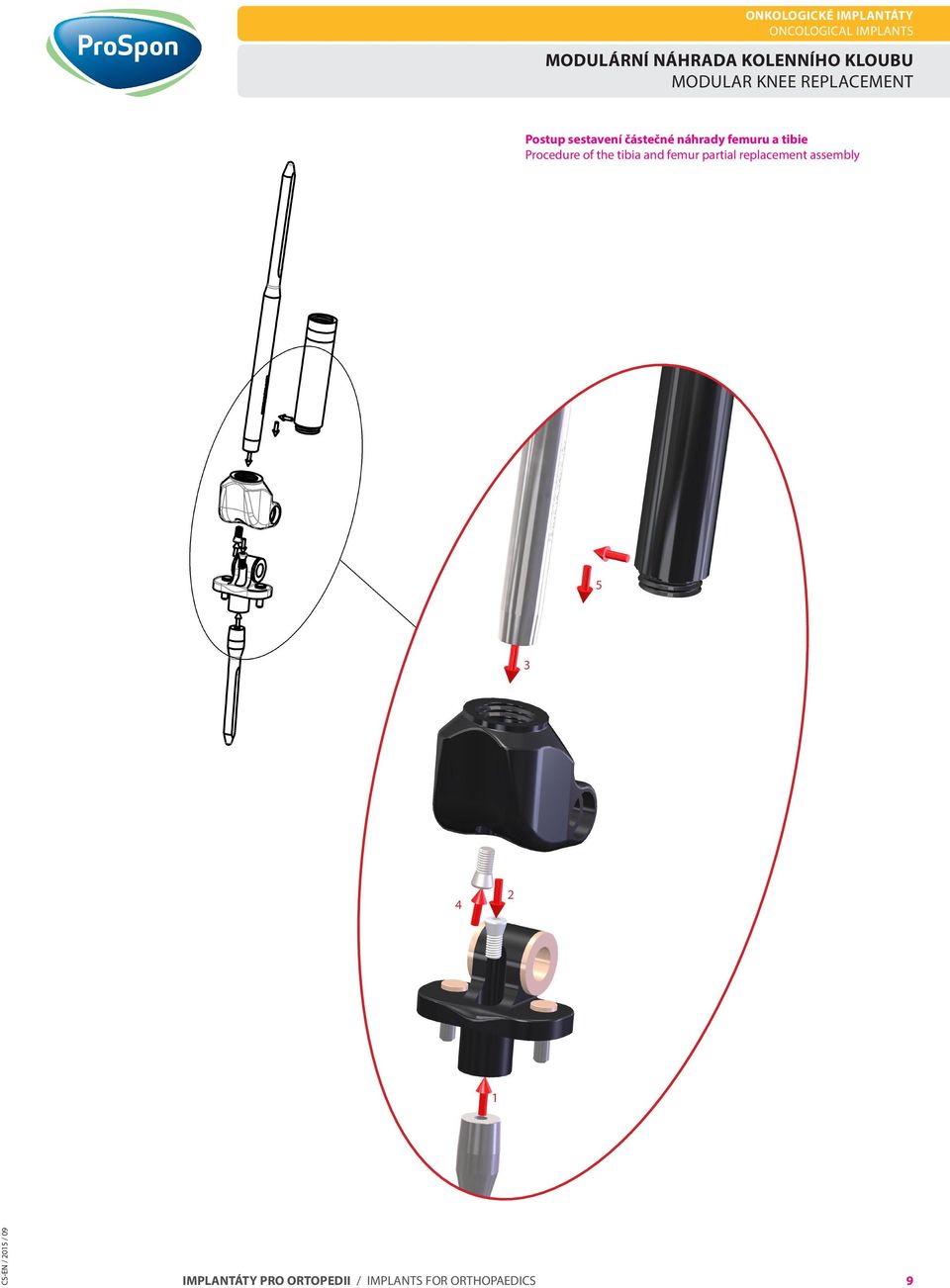 tibie Procedure of the tibia and femur partial replacement