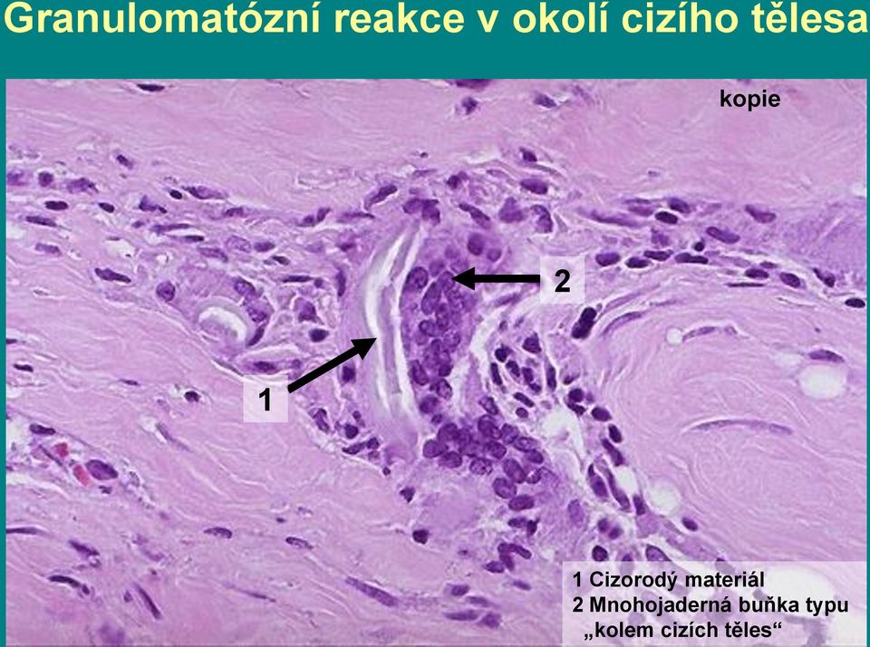 Cizorodý materiál 2