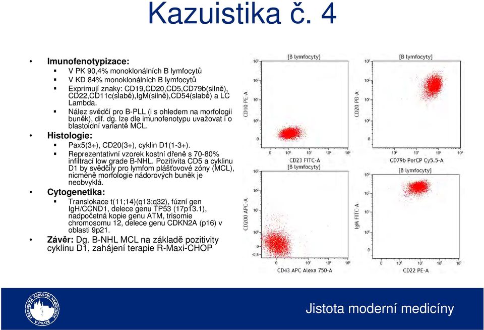 Reprezentativní vzorek kostní dřeně s 70-80% infiltrací low grade B-NHL. Pozitivita CD5 a cyklinu D1 by svědčily pro lymfom plášťovové zóny (MCL), nicméně morfologie nádorových buněk je neobvyklá.