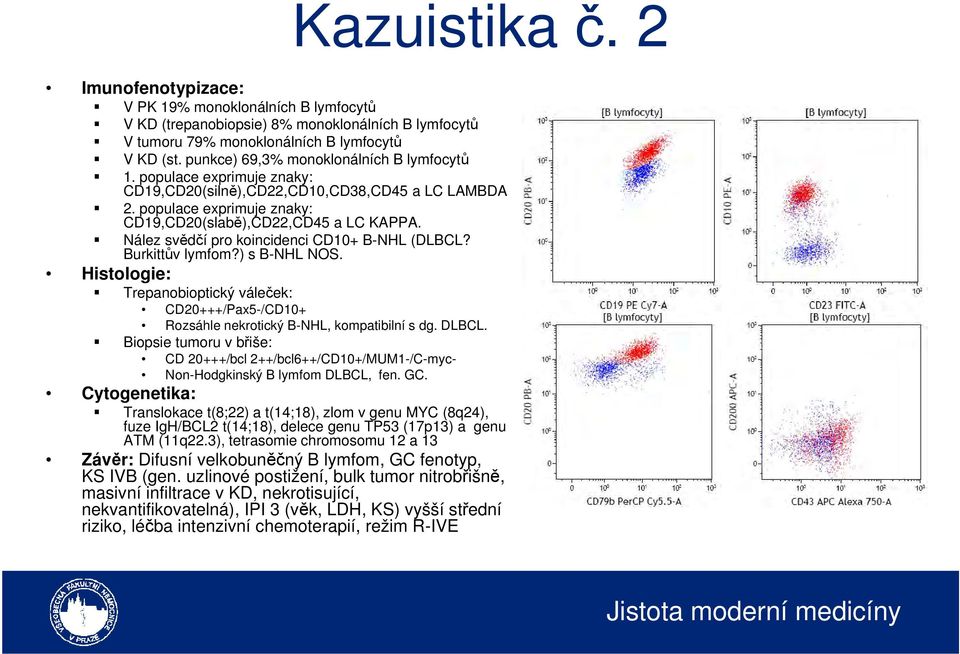 Burkittův lymfom?) s B-NHL NOS. Histologie: Trepanobioptický váleček: CD20+++/Pax5-/CD10+ Rozsáhle nekrotický B-NHL, kompatibilní s dg. DLBCL.